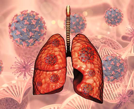 How do viral infections affect the lungs?