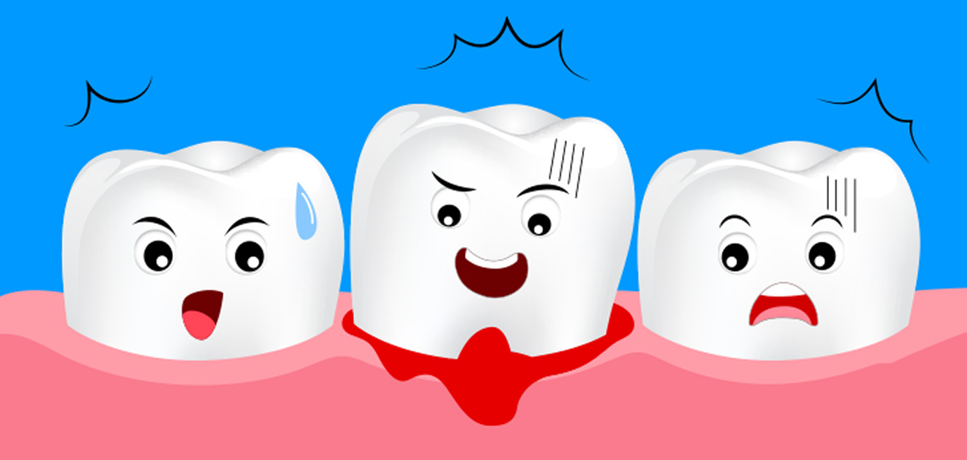 An illustration demonstrating bleeding gums and unhappy teeth