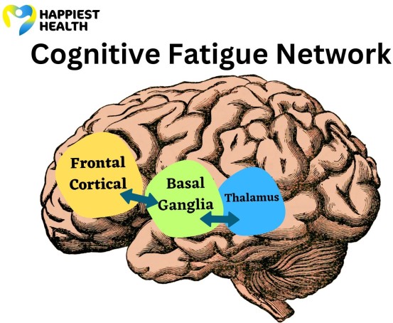 Cognitive Fatigue Network in Multiple Sclerosis