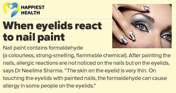 cosmetic allergy - nail polish causes reaction in eyelids