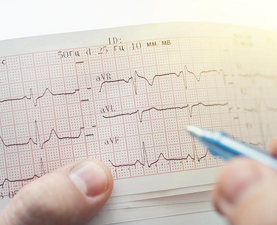 Tachycardia is a persistent faster heart rate that indicates an underlying heart condition