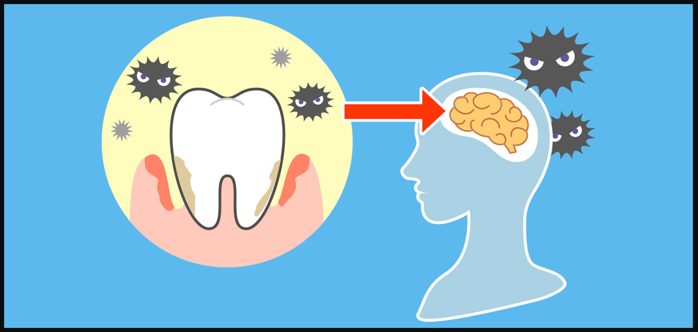 oral health can determine brain health. gum disease can cause neurodegeneration