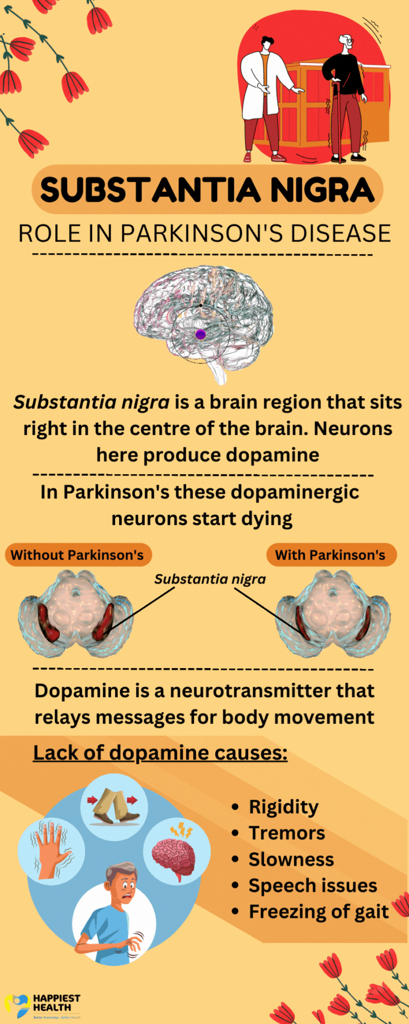 red tulips on the left top corner and right bottom corner- flowers representing Parkinson's. The top right corner has an image of a person with parkinson's and a doctor. Substantia Nigra- its role in Parkinson's disease Image of a side-view of the brain with an animation of dopamine chemical structure radiating from the midbrain , specifically from right above the basal ganglia, which is right above the amygdala. Substantia nigra is a brain region that sits right in the centre of the brain. Neurons here produce dopamine In Parkinson's these dopaminergic neurons start dying. Two images of the brain from a bottom view where a shrunken substantia nigra can be seen in the case of parkinson's. Dopamine is a neurotransmitter that relays messages for body movement Lack of dopamine causes: Rigidity Tremors Slowness Speech issues Freezing of gait with an image on the right of the text that shows the illustration of the symptoms