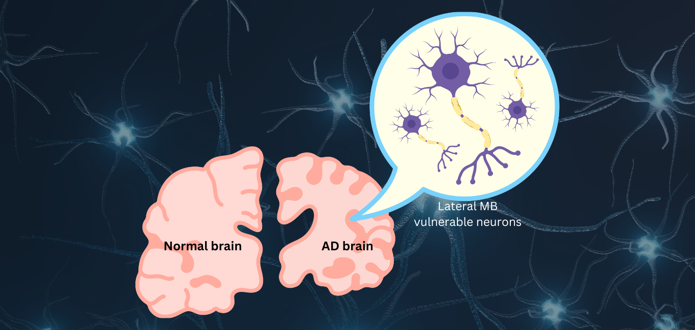 Vulnerable Neurons in Alzheimer's disease
