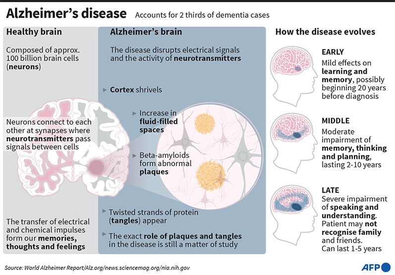Alzheimer’s disease accounts for 60-80% of dementia, according to the Alzheimer’s Association. 