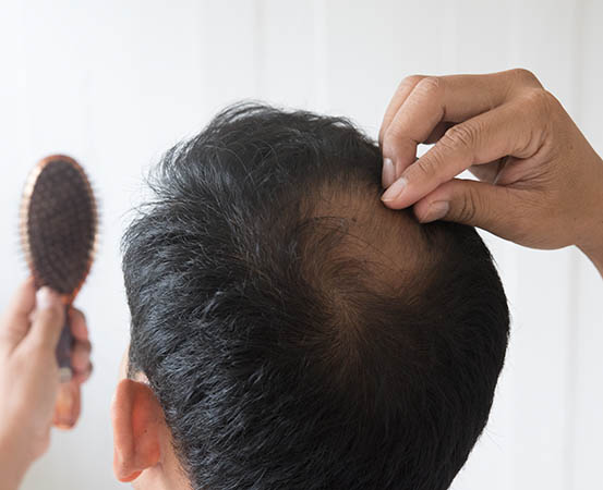 Diabetes and hair loss are connected due to various factors like stress and poor blood circulation.