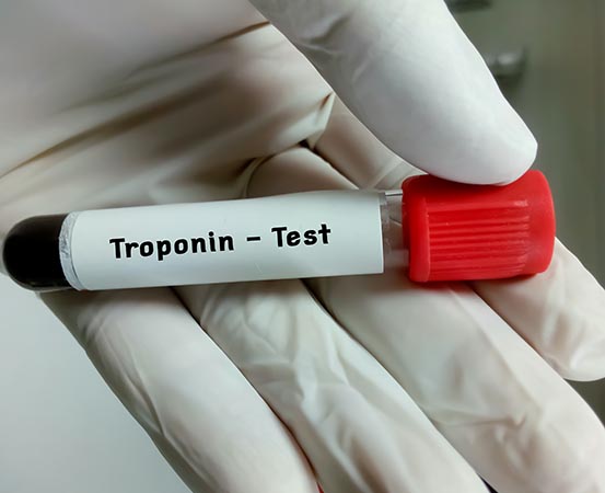 Troponin test measures the levels of troponin in your bloodstream, as high levels of it can confirm a heart attack