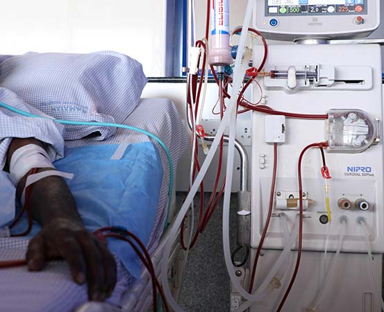 Peritoneal dialysis is a type of dialysis that one can do at home with proper medical guidance.