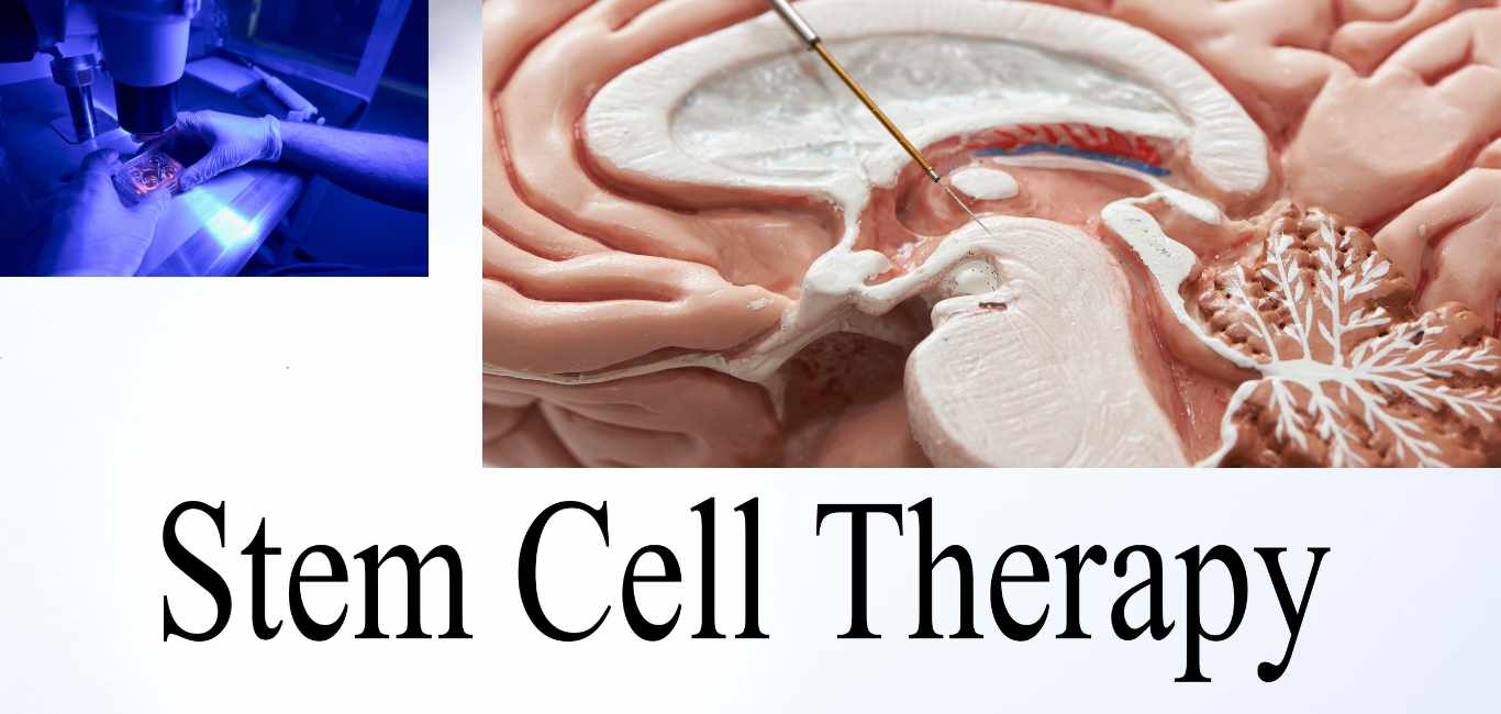 Stem-cell based therapy for Parkinson's